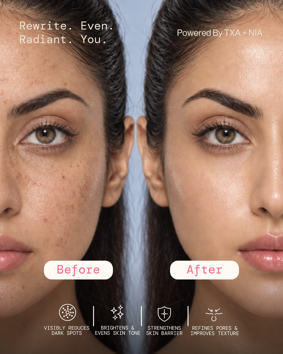 Before and after using S19 TXA + NIA Capsule Cream